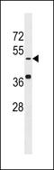 Kringle Containing Transmembrane Protein 1 antibody, LS-C97716, Lifespan Biosciences, Western Blot image 