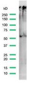 DNA Nucleotidylexotransferase antibody, MBS303071, MyBioSource, Western Blot image 