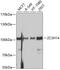 Zinc Finger CCCH-Type Containing 14 antibody, A03312, Boster Biological Technology, Western Blot image 