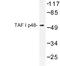 TATA-Box Binding Protein Associated Factor, RNA Polymerase I Subunit A antibody, LS-C176935, Lifespan Biosciences, Western Blot image 