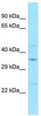 Sphingosine-1-Phosphate Receptor 2 antibody, TA338190, Origene, Western Blot image 