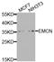 EMCN antibody, A8494, ABclonal Technology, Western Blot image 