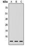 Lymphocyte Antigen 6 Family Member E antibody, MBS8216921, MyBioSource, Western Blot image 