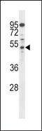 AP2M1 antibody, PA5-71903, Invitrogen Antibodies, Western Blot image 