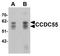 Nuclear Speckle Splicing Regulatory Protein 1 antibody, LS-C144431, Lifespan Biosciences, Western Blot image 