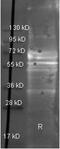 Fibrinogen Alpha Chain antibody, PA1-26809, Invitrogen Antibodies, Western Blot image 