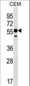 Ring Finger Protein 8 antibody, LS-C162668, Lifespan Biosciences, Western Blot image 