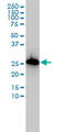 AIF1 antibody, LS-C196632, Lifespan Biosciences, Western Blot image 