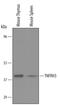 Tumor necrosis factor receptor superfamily member 26 antibody, PA5-47723, Invitrogen Antibodies, Western Blot image 