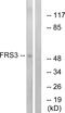 Fibroblast Growth Factor Receptor Substrate 3 antibody, PA5-38921, Invitrogen Antibodies, Western Blot image 