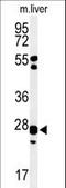 Glutathione S-Transferase Kappa 1 antibody, LS-C166707, Lifespan Biosciences, Western Blot image 