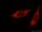 N-Myristoyltransferase 1 antibody, 11546-1-AP, Proteintech Group, Immunofluorescence image 