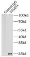 RB3 antibody, FNab08343, FineTest, Immunoprecipitation image 