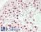 Zinc Fingers And Homeoboxes 2 antibody, LS-B13956, Lifespan Biosciences, Immunohistochemistry paraffin image 