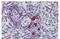 Linker For Activation Of T Cells Family Member 2 antibody, NBP1-44948, Novus Biologicals, Immunohistochemistry paraffin image 