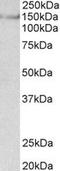 Synaptic Ras GTPase Activating Protein 1 antibody, TA309526, Origene, Western Blot image 