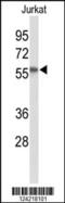 Phosphatidylinositide phosphatase SAC1 antibody, 64-003, ProSci, Western Blot image 