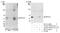 Calcineurin A antibody, NB110-40552, Novus Biologicals, Western Blot image 