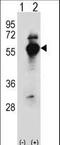 Aspartyl-TRNA Synthetase antibody, LS-C167270, Lifespan Biosciences, Western Blot image 