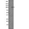 Activated CDC42 kinase 1 antibody, abx219040, Abbexa, Western Blot image 