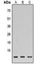 Diazepam Binding Inhibitor, Acyl-CoA Binding Protein antibody, orb256489, Biorbyt, Western Blot image 