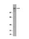 Glutamate Ionotropic Receptor NMDA Type Subunit 2B antibody, NBP2-29790, Novus Biologicals, Western Blot image 