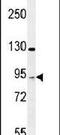 T Cell Activation RhoGTPase Activating Protein antibody, PA5-24442, Invitrogen Antibodies, Western Blot image 