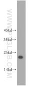 Ubiquitin Conjugating Enzyme E2 F (Putative) antibody, 17056-1-AP, Proteintech Group, Western Blot image 