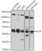 Krueppel-like factor 8 antibody, 16-552, ProSci, Western Blot image 