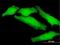 Pleckstrin Homology Domain Containing O1 antibody, H00051177-B01P, Novus Biologicals, Immunocytochemistry image 