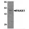 Pannexin 1 antibody, MBS153724, MyBioSource, Western Blot image 