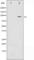 Neurotrophic Receptor Tyrosine Kinase 2 antibody, abx012019, Abbexa, Western Blot image 