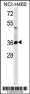 ATPase Na+/K+ Transporting Subunit Beta 3 antibody, 56-621, ProSci, Western Blot image 
