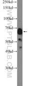 Glypican 3 antibody, 25175-1-AP, Proteintech Group, Western Blot image 