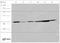 Eukaryotic translation initiation factor 2 subunit 1 antibody, GTX50590, GeneTex, Western Blot image 