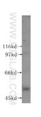 Lactotransferrin antibody, 10933-1-AP, Proteintech Group, Western Blot image 
