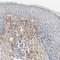 Transforming Growth Factor Beta Induced antibody, NBP1-88606, Novus Biologicals, Immunohistochemistry paraffin image 