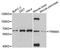 Tripartite Motif Containing 45 antibody, A11409, Boster Biological Technology, Western Blot image 