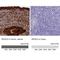 WAP Four-Disulfide Core Domain 2 antibody, NBP2-48762, Novus Biologicals, Immunohistochemistry paraffin image 