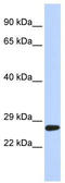 SET Domain Containing 4 antibody, TA335545, Origene, Western Blot image 