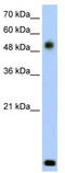 Radical S-Adenosyl Methionine Domain Containing 2 antibody, TA329506, Origene, Western Blot image 