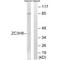 Zinc Finger CCCH-Type Containing 8 antibody, A12985, Boster Biological Technology, Western Blot image 