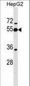 Peptidase Inhibitor 16 antibody, LS-C158657, Lifespan Biosciences, Western Blot image 