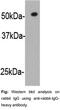 Immunoglobulin Heavy Constant Gamma 1 (G1m Marker) antibody, MBS850876, MyBioSource, Western Blot image 