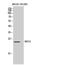 RAS Like Family 10 Member A antibody, A12803, Boster Biological Technology, Western Blot image 