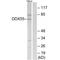 DEAD-Box Helicase 55 antibody, A12850, Boster Biological Technology, Western Blot image 