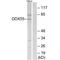 DEAD-Box Helicase 55 antibody, A12850, Boster Biological Technology, Western Blot image 