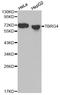 Protein TBRG4 antibody, LS-C330889, Lifespan Biosciences, Western Blot image 