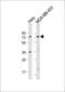 Coiled-Coil Domain Containing 81 antibody, 55-869, ProSci, Western Blot image 