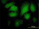 Arrestin Beta 2 antibody, H00000409-M06, Novus Biologicals, Immunofluorescence image 